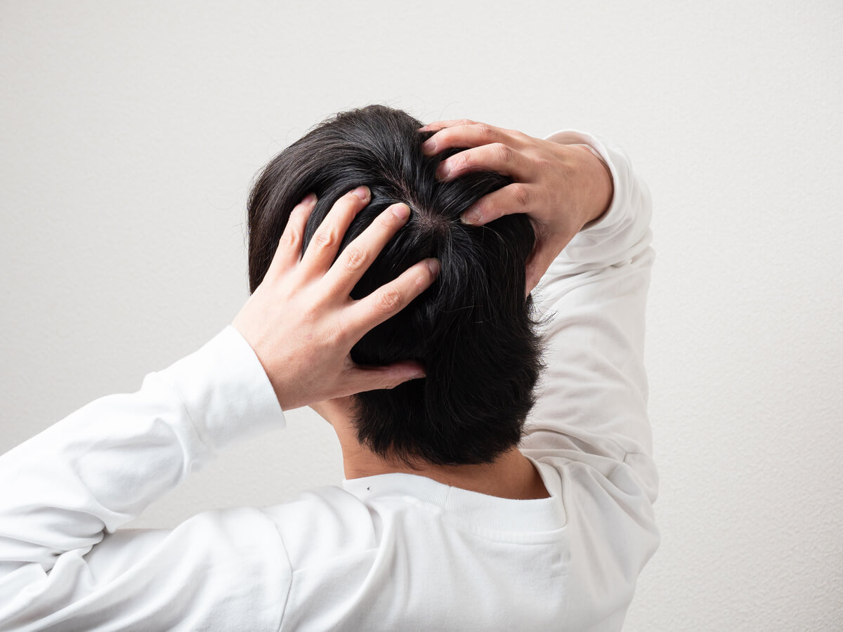 生え際の薄毛をより改善しやすくするためのコツ