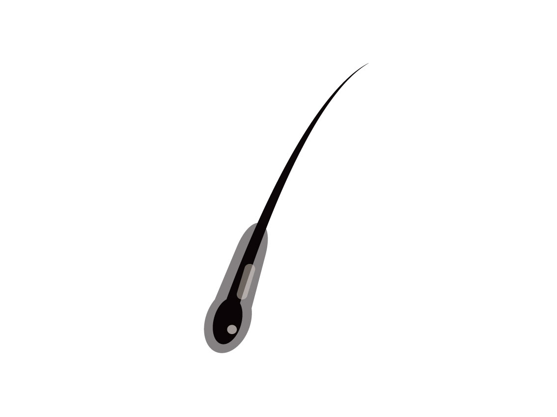 【画像付き】正常な抜け毛の状態とは?