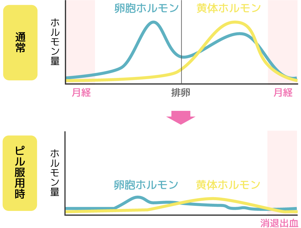 ピルの服用が薄毛・抜け毛の原因になる理由