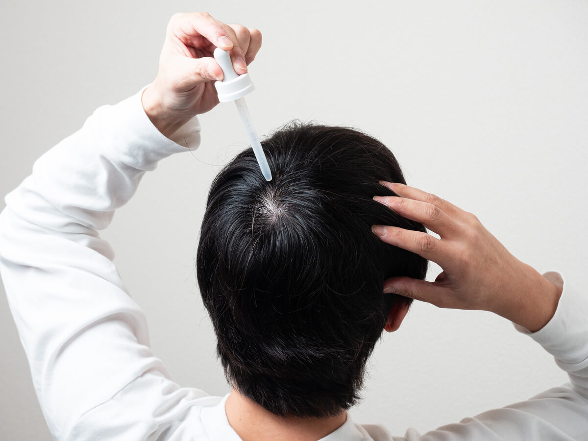 季節性の抜け毛に備えたい男性向けの対策を紹介
