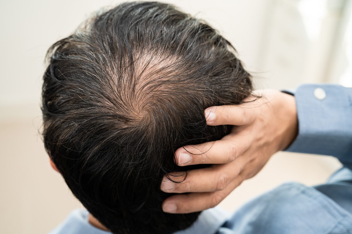 なぜ抜け毛が細いと注意すべきなのか？