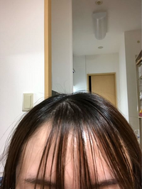 体験談①《前髪が悲惨なことに...》
