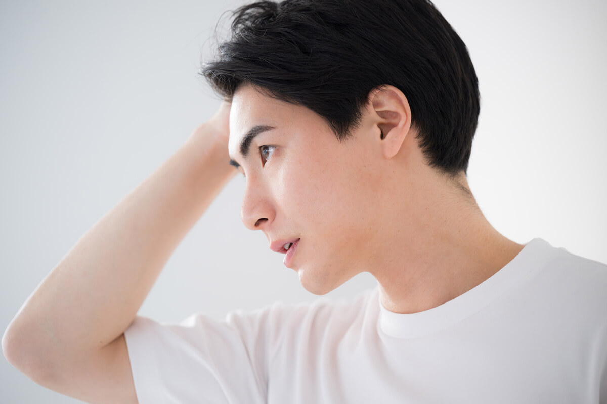 生まれつきおでこが広くて生え際が後退したと感じる場合もある