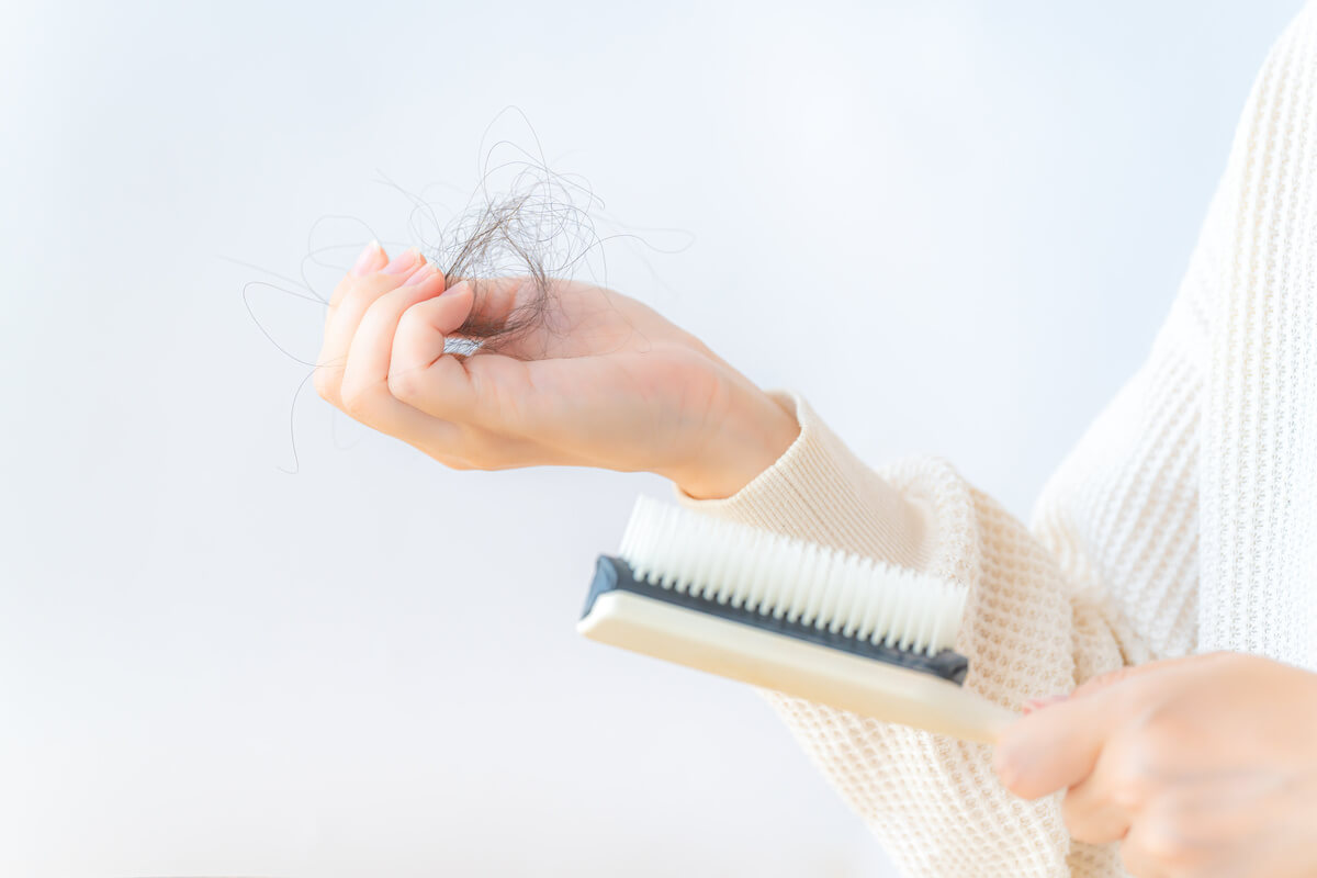 大学生での生え際の後退は男女どちらにも起こりうる