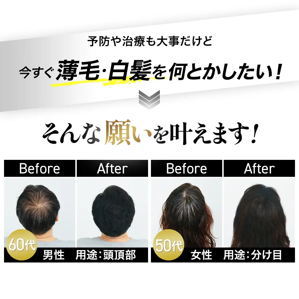 予防も治療も大事だけど今すぐ薄毛・白髪を何とかしたい！