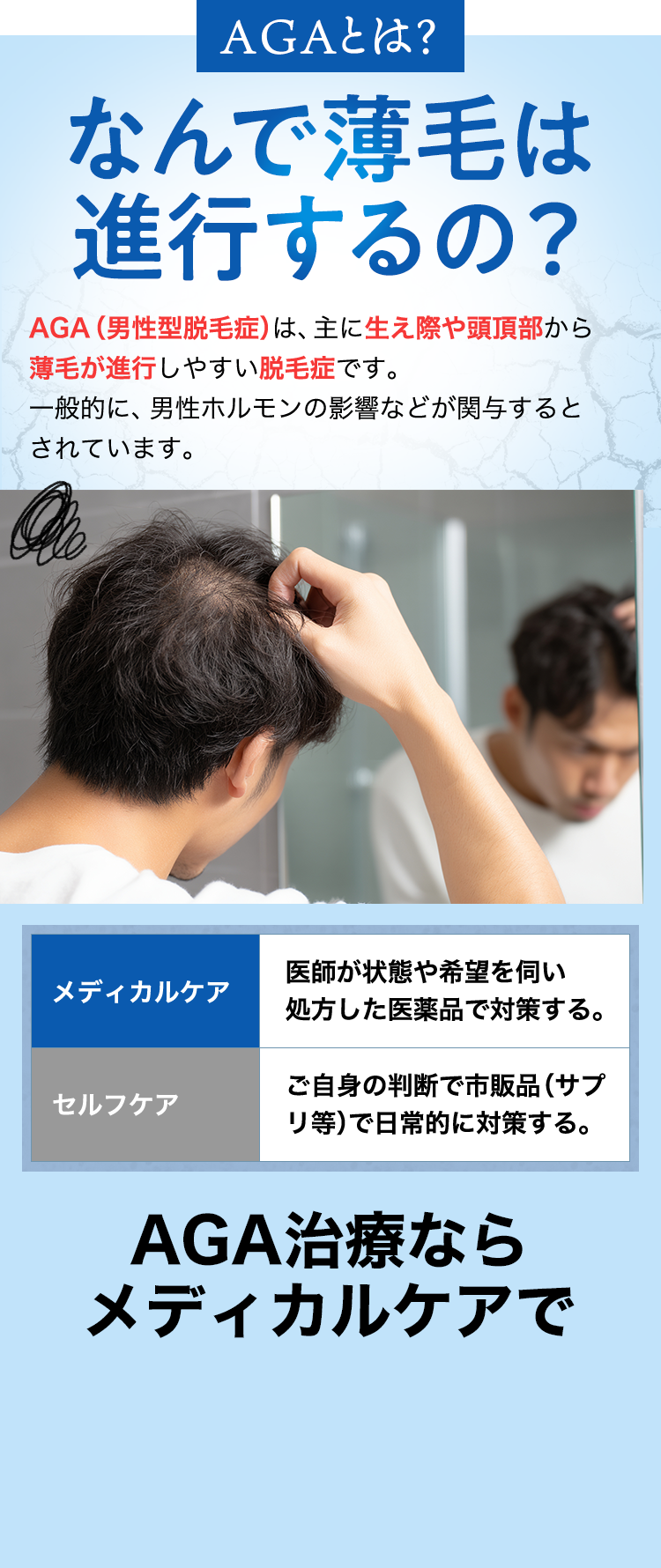 AGAとは？なんで薄毛は進行するの？