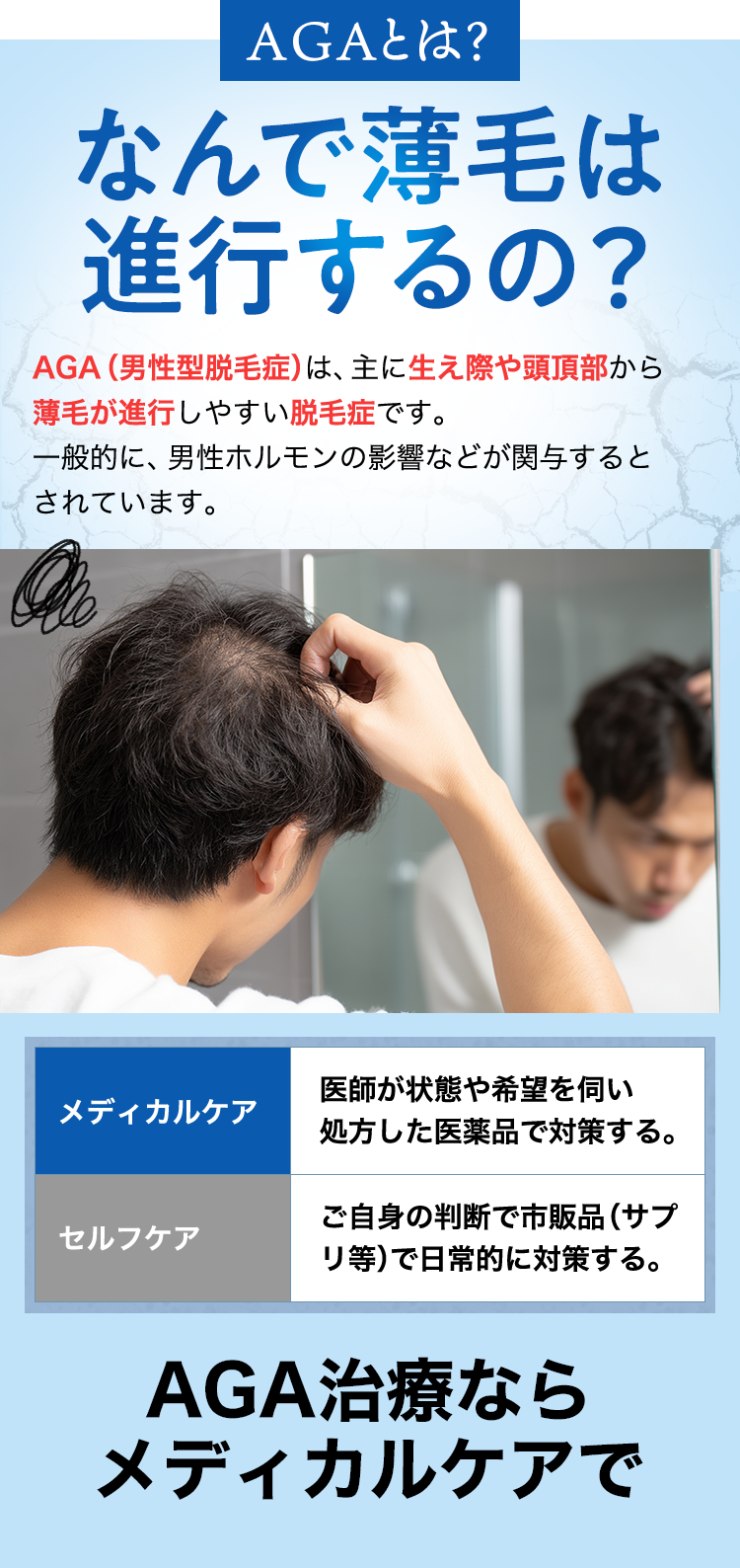 AGAとは？なんで薄毛は進行するの？