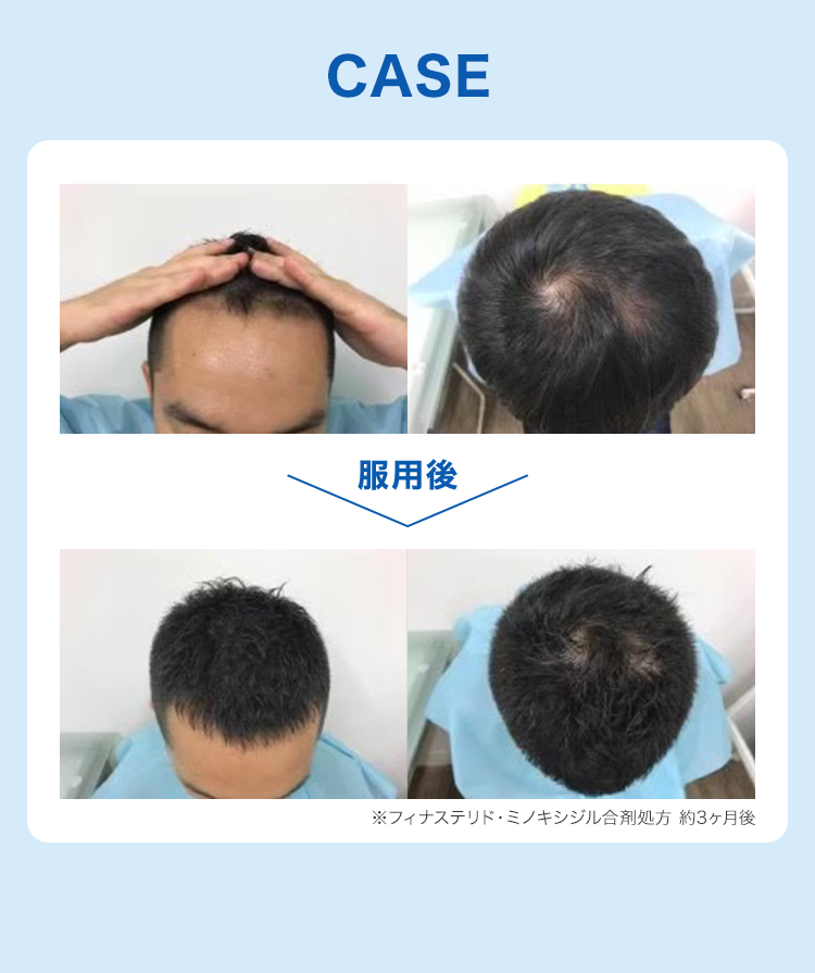 CASE